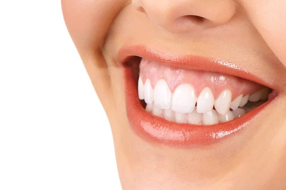 gummy smile orthodontics