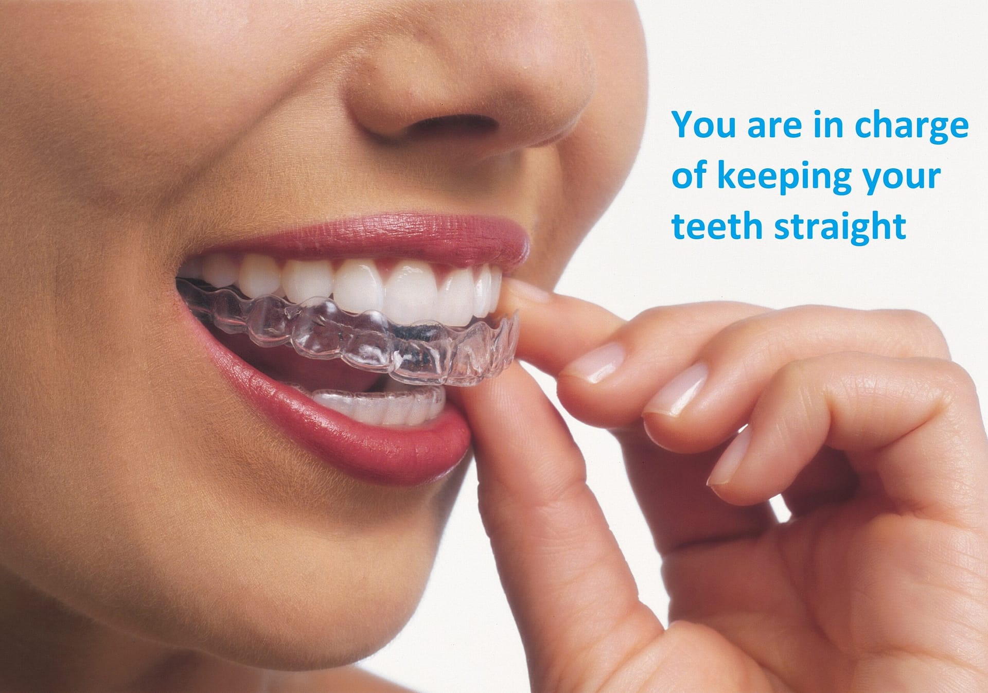 keeping teeth straight with retainers